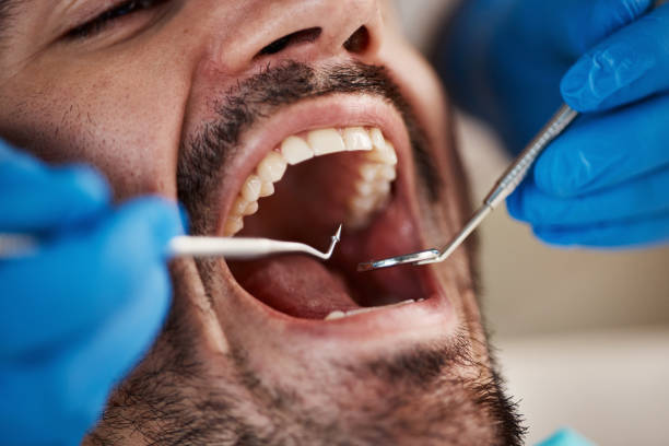 Best Emergency Root Canal Therapy in Landmk, AR